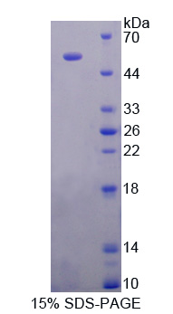 Recombinant Ornithine Decarboxylase (ODC)
