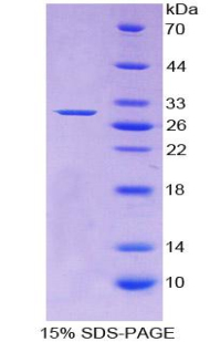 Recombinant Adenylate Cyclase 1, Brain (ADCY1)