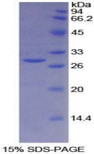 Recombinant Breast Cancer Susceptibility Protein 2 (BRCA2)