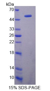 Recombinant Cluster Of Differentiation 74 (CD74)