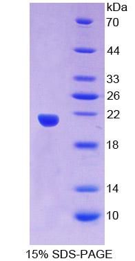 Recombinant Small Nuclear Ribonucleoprotein Polypeptide C (SNRPC)