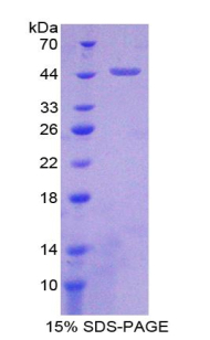 Recombinant Cluster Of Differentiation 97 (CD97)