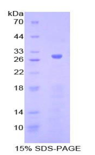 Recombinant Adenylate Cyclase 5 (ADCY5)