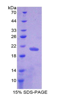 Recombinant Nuclear Pore Glycoprotein 210 (gp210)