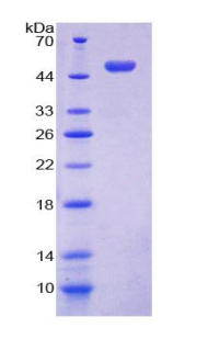 Recombinant Placental Protein 13 (PP13)