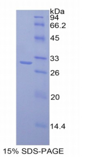 Recombinant Mucosal Addressin Cell Adhesion Molecule 1 (MAdCAM1)