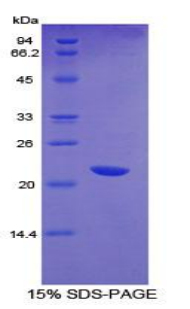 Recombinant Cluster Of Differentiation 36 (CD36)