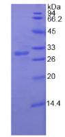 Recombinant Probable ATP-dependent RNA Helicase DDX58 (DDX58)