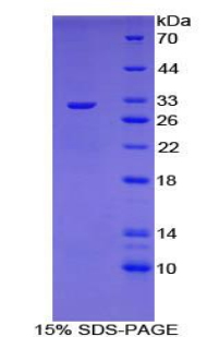 Recombinant Cytochrome P450 Family 21 Subfamily A Member 2 (CYP21A2)