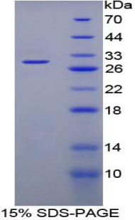 Recombinant Cytochrome P450 Family 21 Subfamily A Member 2 (CYP21A2)