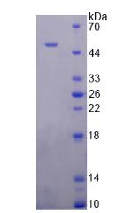 Recombinant Surfactant Protein B (SP-B)