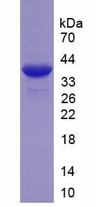 Recombinant Latent Transforming Growth Factor Beta Binding Protein 2 (LTBP2)