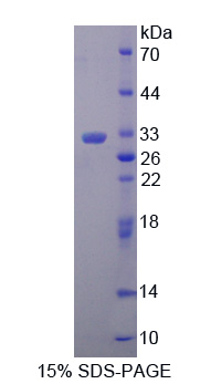 Recombinant Electron Transfer Flavoprotein Beta Polypeptide (ETFb)