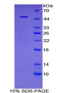 Recombinant Major Basic Protein (MBP)