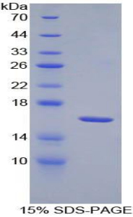 Recombinant Interleukin 18 Receptor 1 (IL18R1)