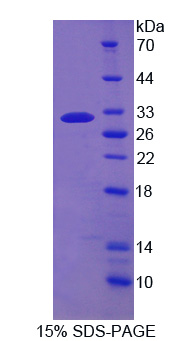 Recombinant Cluster Of Differentiation 226 (CD226)
