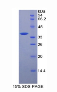 Recombinant Cluster Of Differentiation 146 (CD146)