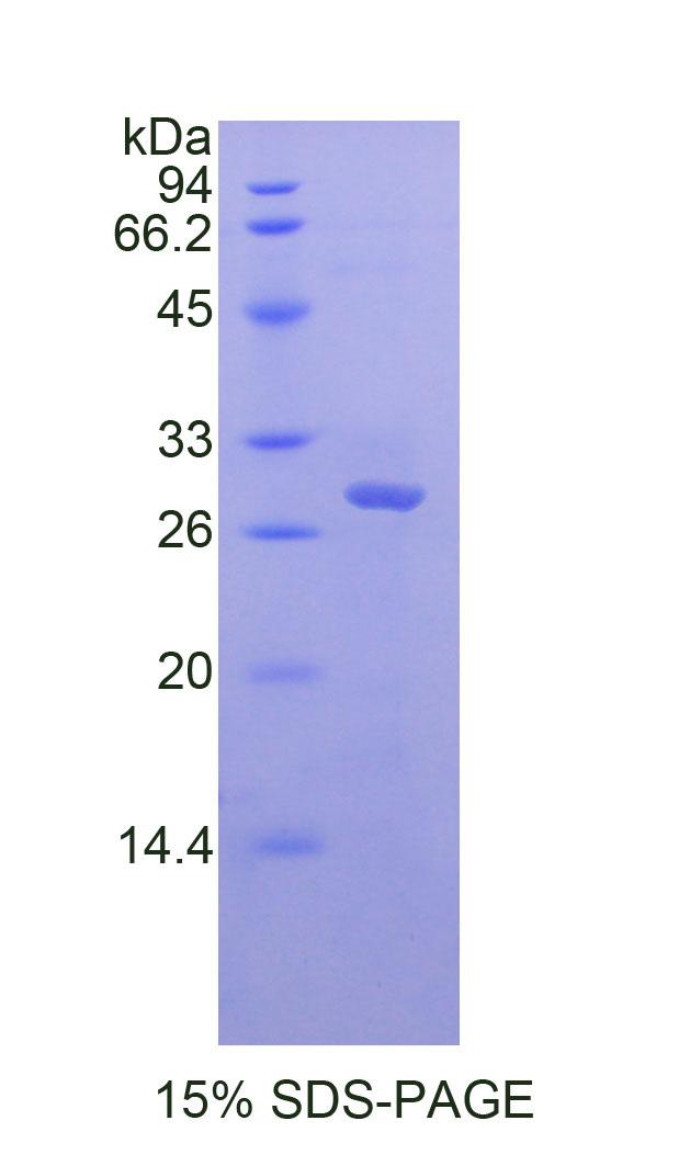Recombinant Myeloid Differentiation Factor 88 (MyD88)