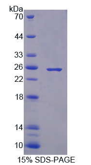 Recombinant Cluster of Differentiation 244 (CD244)