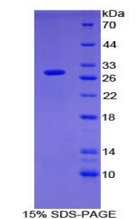 Recombinant Oncoprotein Induced Transcript 3 (OIT3)
