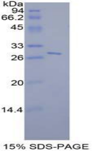 Recombinant Signal Transducer And Activator Of Transcription 6 (STAT6)