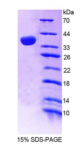 Recombinant Guanylate Binding Protein 4 (GBP4)