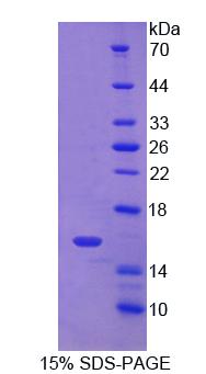 Recombinant Cluster Of Differentiation 7 (CD7)
