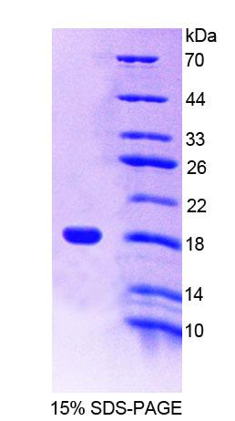 Recombinant Cluster Of Differentiation 7 (CD7)