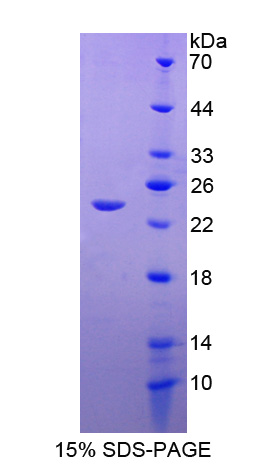 Recombinant Squamous Cell Carcinoma Antigen 1/2 (SCCA1/SCCA2)