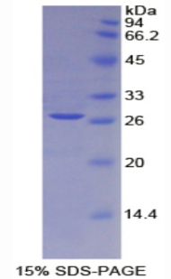 Recombinant Interleukin 2 Receptor Alpha (IL2Ra)