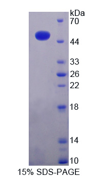 Recombinant Matrix Metalloproteinase 19 (MMP19)