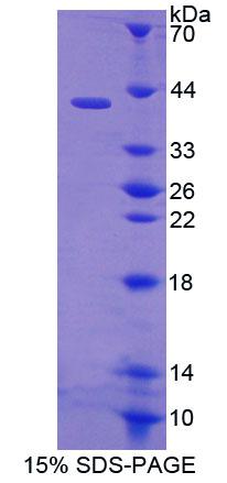 Recombinant Receptor Tyrosine Protein Kinase erbB-2 (ErbB2)