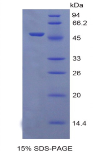 Recombinant Receptor Tyrosine Protein Kinase erbB-2 (ErbB2)