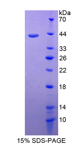 Recombinant Cluster Of Differentiation 3d (CD3d)