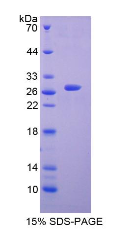 Recombinant Choline Acetyltransferase (ChAT)