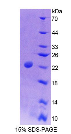 Recombinant Sperm Protein 17 (Sp17)