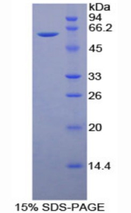 Recombinant Cluster Of Differentiation 34 (CD34)