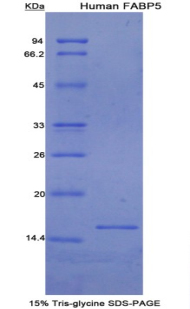 Recombinant Fatty Acid Binding Protein 5 (FABP5)