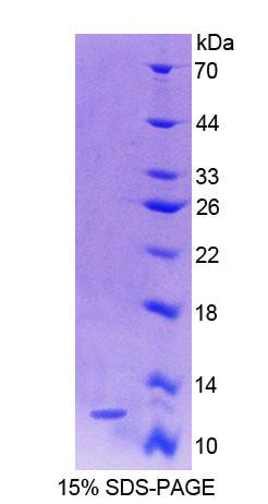 Recombinant S100 Calcium Binding Protein A4 (S100A4)