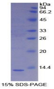 Recombinant S100 Calcium Binding Protein A4 (S100A4)