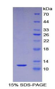 Recombinant S100 Calcium Binding Protein A5 (S100A5)