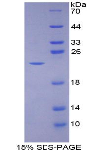 Recombinant Bone Morphogenetic Protein 3 (BMP3)