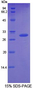 Recombinant Growth Differentiation Factor 11 (GDF11)
