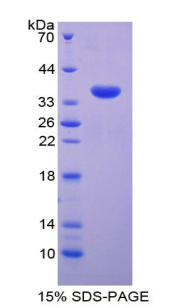 Recombinant Growth Differentiation Factor 10 (GDF10)