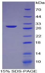 Recombinant Collagen Type IV Alpha 2 (COL4a2)