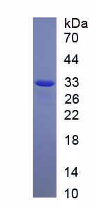 Recombinant Collagen Type XI Alpha 1 (COL11a1)