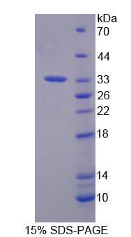 Recombinant Left/Right Determination Factor 1 (LEFTY1)