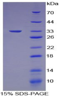 Recombinant E1A Binding Protein P300 (EP300)