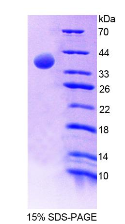 Recombinant Erythrocyte Membrane Protein Band 4.1 (EPB41)