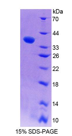 Recombinant Erythrocyte Membrane Protein Band 4.1 (EPB41)